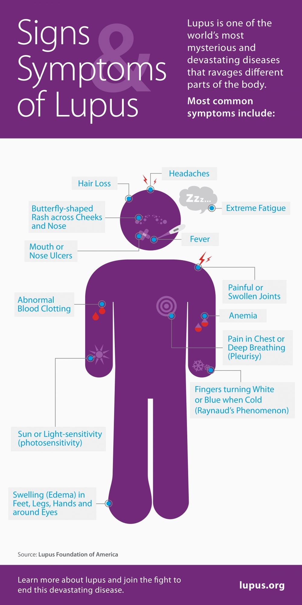 Lupus symptoms infographics